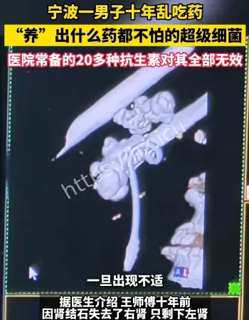 男子吃抗生素生